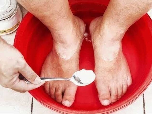 soda kopeli za glivice