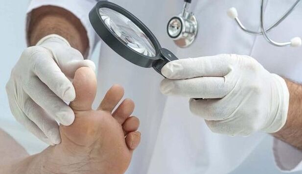 Diagnoza glivic
